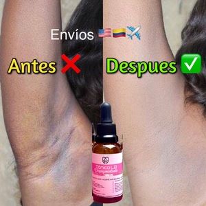 MTonico Despigmentante 🇨🇴 *Eliminador de manchas* Removes dark spots